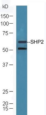 SHP-2/PTPN11 Antibody in Western Blot (WB)
