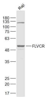 FLVCR Antibody in Western Blot (WB)