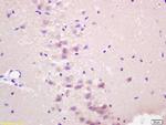 RASSF1 Antibody in Immunohistochemistry (Paraffin) (IHC (P))