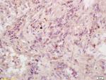 RASSF1 Antibody in Immunohistochemistry (Paraffin) (IHC (P))