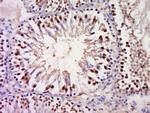 GSC Antibody in Immunohistochemistry (Paraffin) (IHC (P))