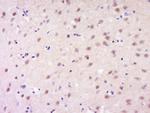 GSC Antibody in Immunohistochemistry (Paraffin) (IHC (P))