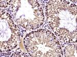 TUG/ASPC Antibody in Immunohistochemistry (Paraffin) (IHC (P))