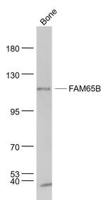 FAM65B Antibody in Western Blot (WB)