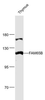 FAM65B Antibody in Western Blot (WB)