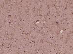 KIF13B Antibody in Immunohistochemistry (Paraffin) (IHC (P))