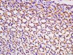 ACVR2B/ACTR2B Antibody in Immunohistochemistry (Paraffin) (IHC (P))