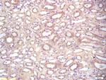BAMBI Antibody in Immunohistochemistry (Paraffin) (IHC (P))