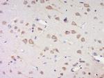 Phospho-Casein kinase 1 isoforms gamma 1/2/3 (Tyr263) Antibody in Immunohistochemistry (Paraffin) (IHC (P))