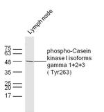 Phospho-Casein kinase 1 isoforms gamma 1/2/3 (Tyr263) Antibody in Western Blot (WB)