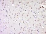 Phospho-Casein Kinase 1 alpha (Tyr294) Antibody in Immunohistochemistry (Paraffin) (IHC (P))