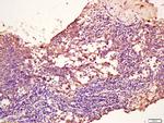 TPM2 Antibody in Immunohistochemistry (Paraffin) (IHC (P))