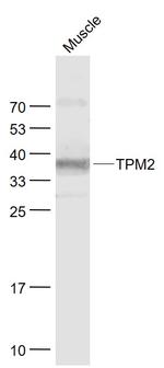 TPM2 Antibody in Western Blot (WB)