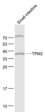 TPM2 Antibody in Western Blot (WB)