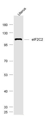 eIF2C2/Ago2 Antibody in Western Blot (WB)