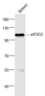 eIF2C2/Ago2 Antibody in Western Blot (WB)