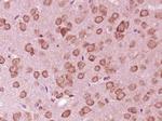 PLEKHG5 Antibody in Immunohistochemistry (Paraffin) (IHC (P))