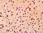 ANKK1 Antibody in Immunohistochemistry (Paraffin) (IHC (P))