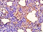 ANKK1 Antibody in Immunohistochemistry (Paraffin) (IHC (P))