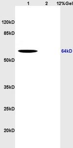 CD166 Antibody in Western Blot (WB)