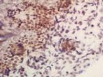 ARID1B Antibody in Immunohistochemistry (Paraffin) (IHC (P))
