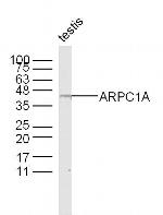 ARPC1A Antibody in Western Blot (WB)