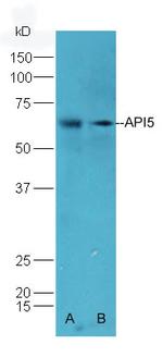 API5 Antibody in Western Blot (WB)