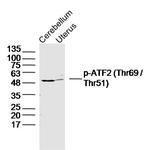 Phospho-ATF2 (Thr69) Antibody in Western Blot (WB)