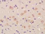 FLRT2 Antibody in Immunohistochemistry (Paraffin) (IHC (P))