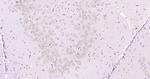 ABH1/ALKB Antibody in Immunohistochemistry (Paraffin) (IHC (P))