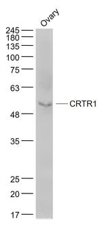 CRTR1 Antibody in Western Blot (WB)