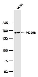 PDS5B Antibody in Western Blot (WB)
