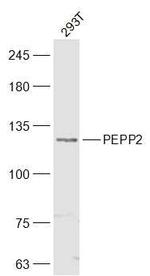 PEPP2 Antibody in Western Blot (WB)