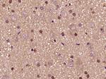 PFKFB3/PFK2 Antibody in Immunohistochemistry (Paraffin) (IHC (P))