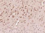 SMCR7 Antibody in Immunohistochemistry (Paraffin) (IHC (P))
