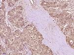 SNF2H Antibody in Immunohistochemistry (Paraffin) (IHC (P))
