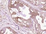 SNF2H Antibody in Immunohistochemistry (Paraffin) (IHC (P))