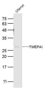 TMEPAI Antibody in Western Blot (WB)