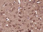 Phospho-DRP1 (Ser616) Antibody in Immunohistochemistry (Paraffin) (IHC (P))