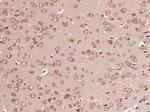 B4GALNT1/GM2 synthase Antibody in Immunohistochemistry (Paraffin) (IHC (P))