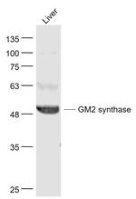 B4GALNT1/GM2 synthase Antibody in Western Blot (WB)