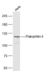 Plakophilin 4 Antibody in Western Blot (WB)