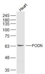 PODN Antibody in Western Blot (WB)