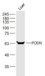 PODN Antibody in Western Blot (WB)