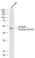 Phospho-Vimentin (Ser55) Antibody in Western Blot (WB)