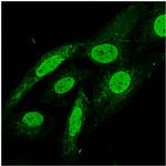 VPS13D Antibody in Immunocytochemistry (ICC/IF)