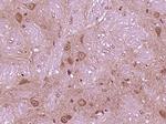 VPS29 Antibody in Immunohistochemistry (Paraffin) (IHC (P))