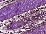 ZNF197 Antibody in Immunohistochemistry (Paraffin) (IHC (P))