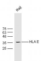 HLA E Antibody in Western Blot (WB)