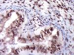 ZNF22 Antibody in Immunohistochemistry (Paraffin) (IHC (P))